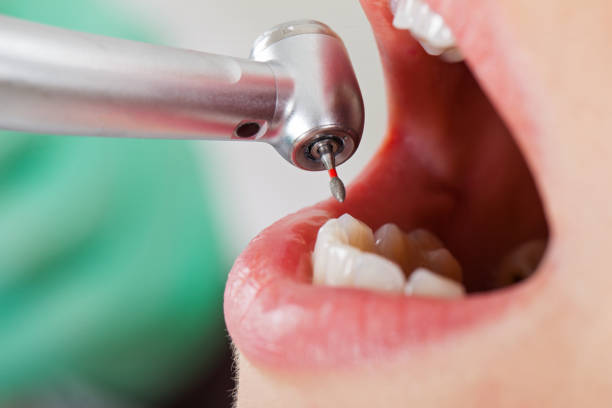 Best Emergency Treatment for Dental Infections or Abscesses in Farley, IA
